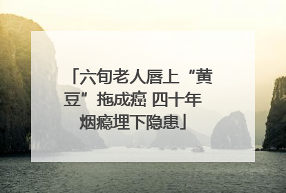 六旬老人唇上“黄豆”拖成癌 四十年烟瘾埋下隐患