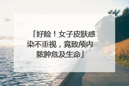 好险！女子皮肤感染不重视，竟致颅内脓肿危及生命