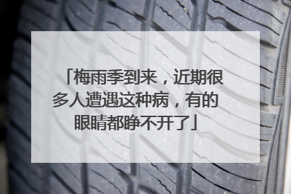 梅雨季到来，近期很多人遭遇这种病，有的眼睛都睁不开了